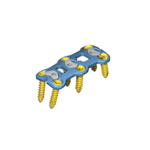 Anterior Cervical Plate System