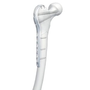 LCP Proximal Femur Hook Plate