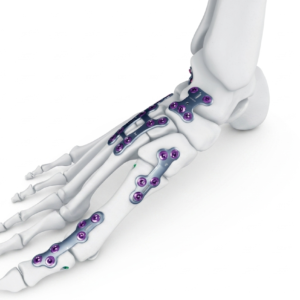 Foot and Ankle