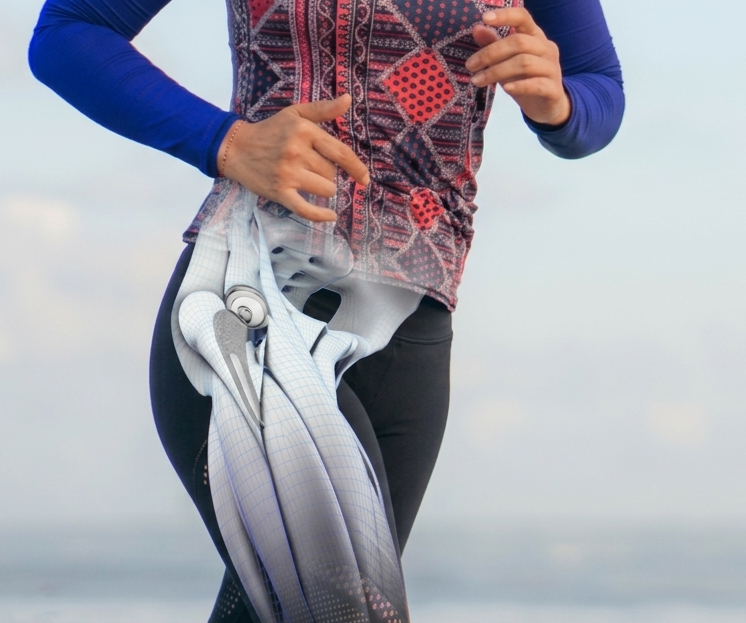 Hip Reconstruction